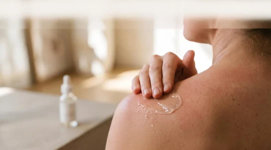 Application délicate d'un soin apaisant sur une peau marquée par un coup de soleil, symbolisant l'usage du CBD pour la réparation cutanée