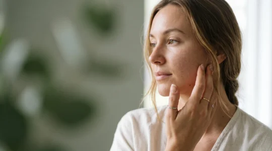 Jeune femme au teint apaisé et lumineux, illustrant les bienfaits du CBD sur les peaux sensibles sujettes à l'acné ou l'eczéma